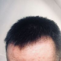 發(fā)際線用戶圖片
