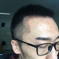 發(fā)際線用戶圖片
