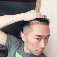 發(fā)際線用戶圖片