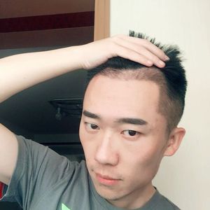 发际线分享社区