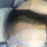 發(fā)際線用戶圖片