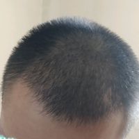 發(fā)際線用戶圖片