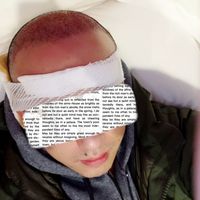 發(fā)際線用戶圖片