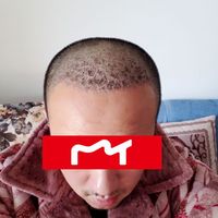 發(fā)際線用戶圖片