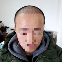 發(fā)際線用戶圖片