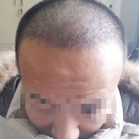 發(fā)際線用戶圖片