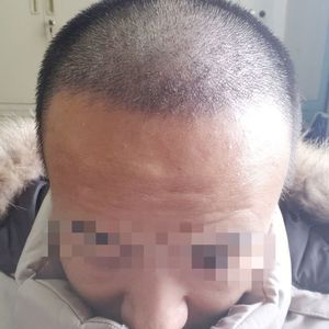 发际线分享社区