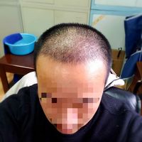 發(fā)際線用戶圖片