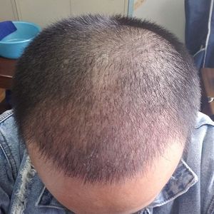 发际线分享社区