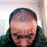 發(fā)際線用戶圖片