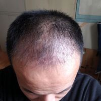 發(fā)際線用戶圖片
