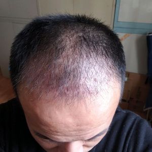 发际线分享社区