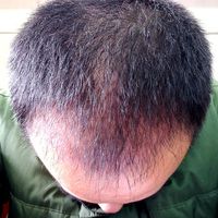發(fā)際線用戶圖片
