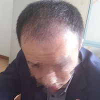 發(fā)際線用戶圖片