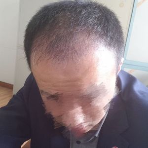 发际线分享社区