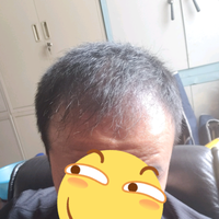 發(fā)際線用戶圖片