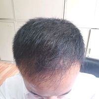 發(fā)際線用戶圖片
