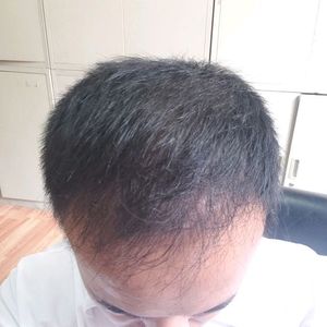 发际线分享社区