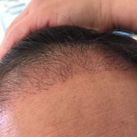 發(fā)際線用戶圖片