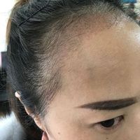 發(fā)際線用戶圖片