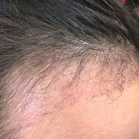 發(fā)際線用戶圖片