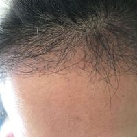發(fā)際線用戶圖片