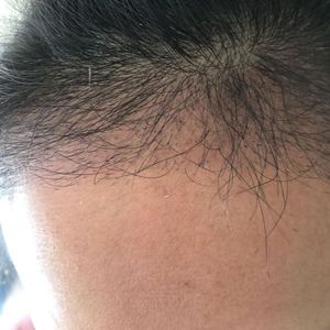 发际线分享社区