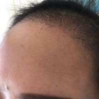 發(fā)際線用戶圖片
