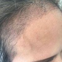 發(fā)際線用戶圖片
