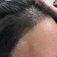 發(fā)際線用戶圖片