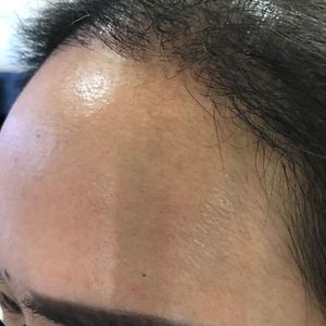 发际线分享社区
