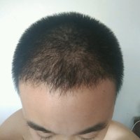 發(fā)際線用戶圖片