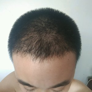 发际线分享社区