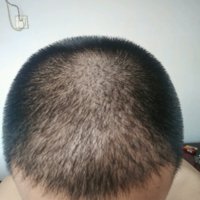 發(fā)際線用戶圖片