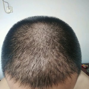发际线分享社区