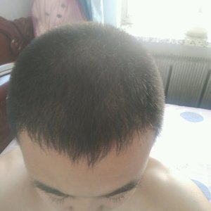 发际线分享社区