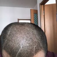 發(fā)際線用戶圖片