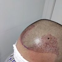 發(fā)際線用戶圖片