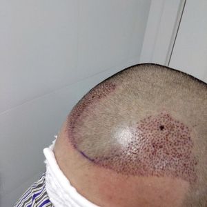 发际线分享社区