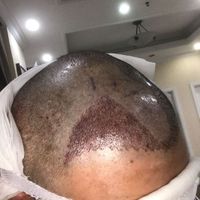 發(fā)際線用戶圖片