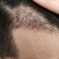 發(fā)際線用戶圖片