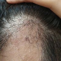 發(fā)際線用戶圖片