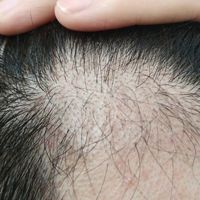 發(fā)際線用戶圖片