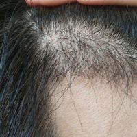 發(fā)際線用戶圖片