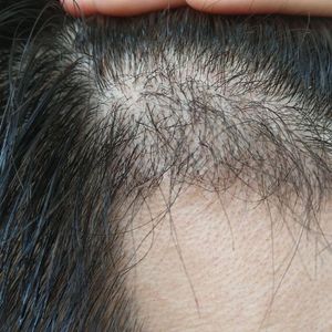 发际线分享社区