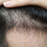 發(fā)際線用戶圖片