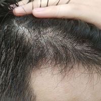 發(fā)際線用戶圖片