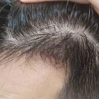 發(fā)際線用戶圖片