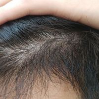 發(fā)際線用戶圖片