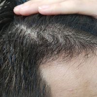 發(fā)際線用戶圖片